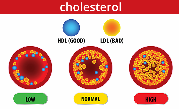 Cholesterol Levels Explained